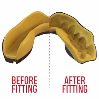 -Зъби-SAFEJAWZ-EXTRO-SERIES-SELF-FIT-GOLDIE-MOUTHGUARD-3.jpg за Зъби SAFEJAWZ EXTRO SERIES SELF FIT GOLDIE MOUTHGUARD 3