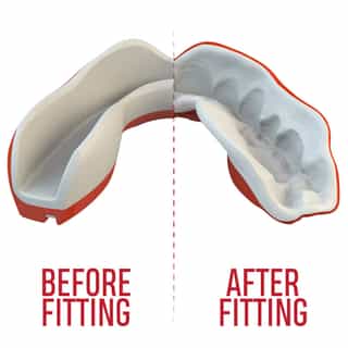 -Зъби-SAFEJAWZ-EXTRO-SERIES-SELF-FIT-VIPER-MOUTHGUARD-3.jpg за Зъби SAFEJAWZ EXTRO SERIES SELF FIT VIPER MOUTHGUARD 3